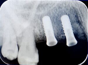 SunshineSmile Beratungszentrum Bern gallery image 4