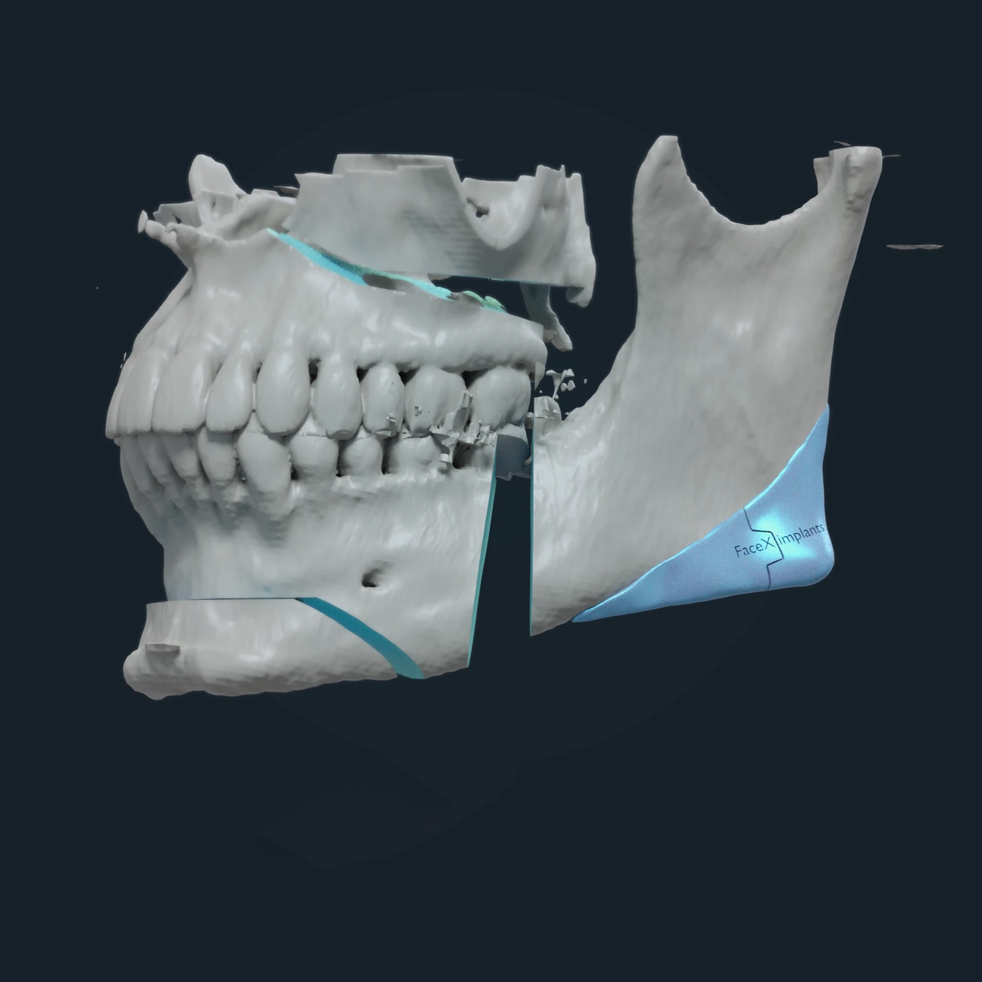 Craniologicum Bern – Dr. Felipe Mercado, Oralchirurgie gallery image 2