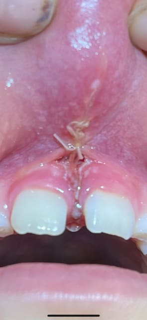 Dr. med. dent. Roland Lauber, Fachzahnarzt für Oralchirurgie, Sportzahnarzt, DGSZM gallery image 7