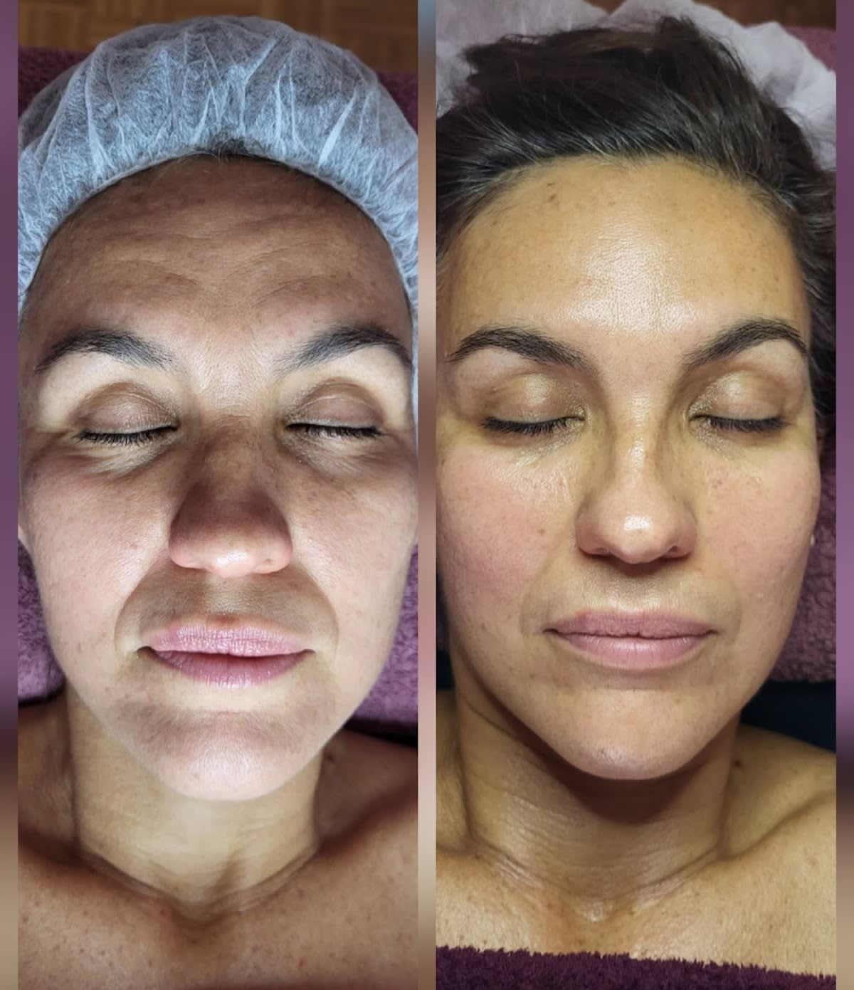 L'AURA (agrée ASCA) KOBIDO, SOINS ESTHÉTIQUES & REFLEXOLOGIE gallery image 8