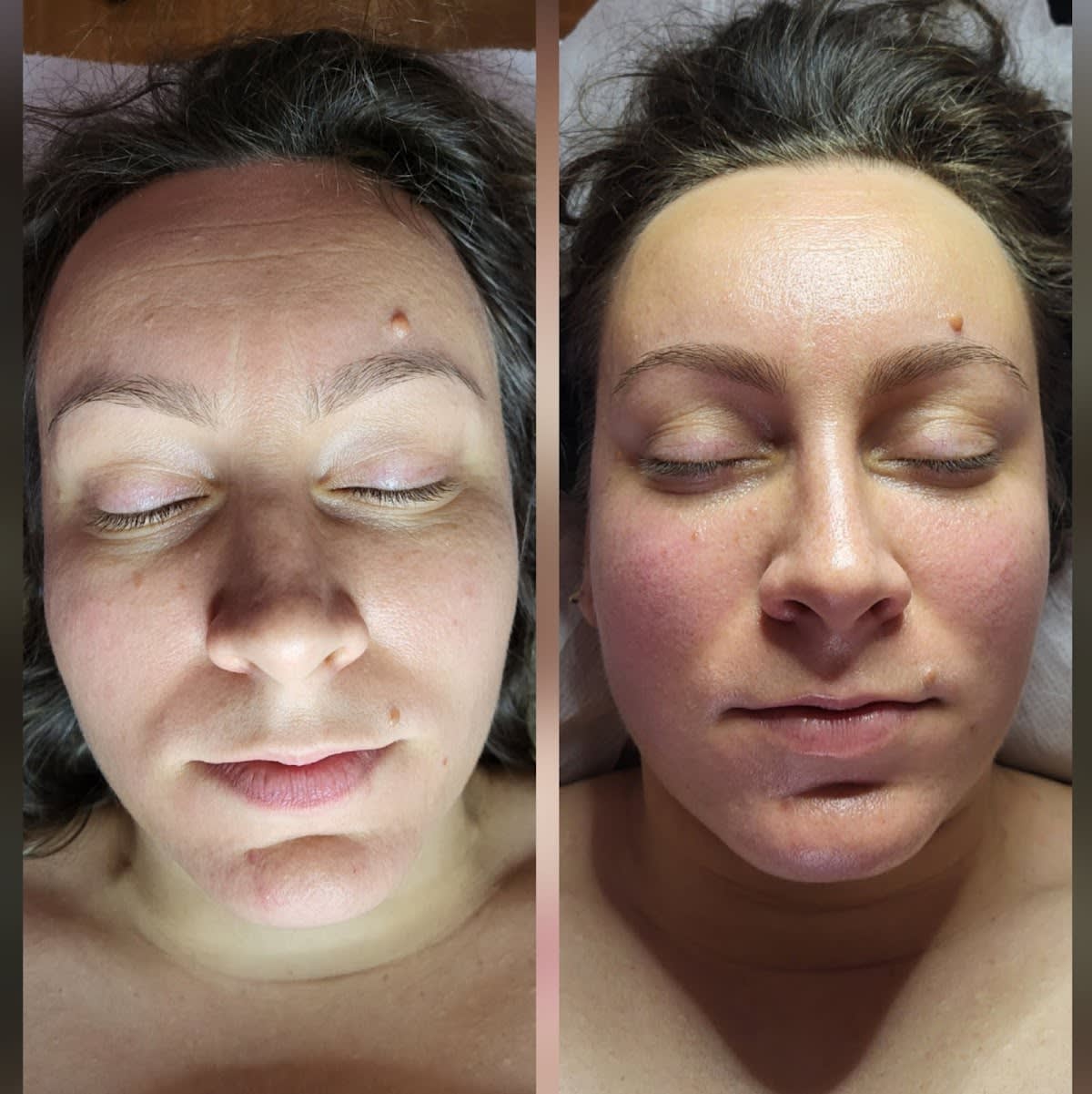 L'AURA (agrée ASCA) KOBIDO, SOINS ESTHÉTIQUES & REFLEXOLOGIE gallery image 9