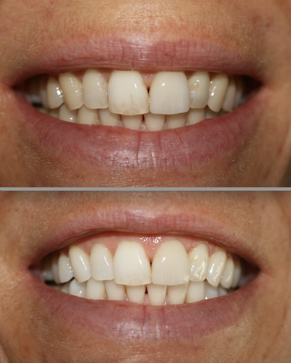 Studio d'igiene dentale indipendente Milena Scaroni, Praxis für Dentalhygiene, Cabinet d'hygiène dentaire gallery image 7