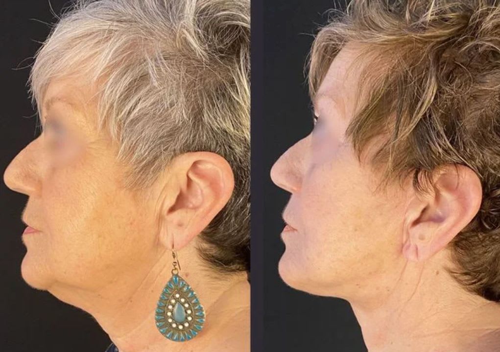 Docteur Jean-Charles Bayol - Chirurgien esthétique Genève gallery image 10