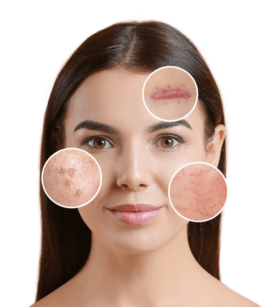 CLINIK Fribourg | Spécialiste en Épilation Laser et Rajeunissement Laser gallery image 4