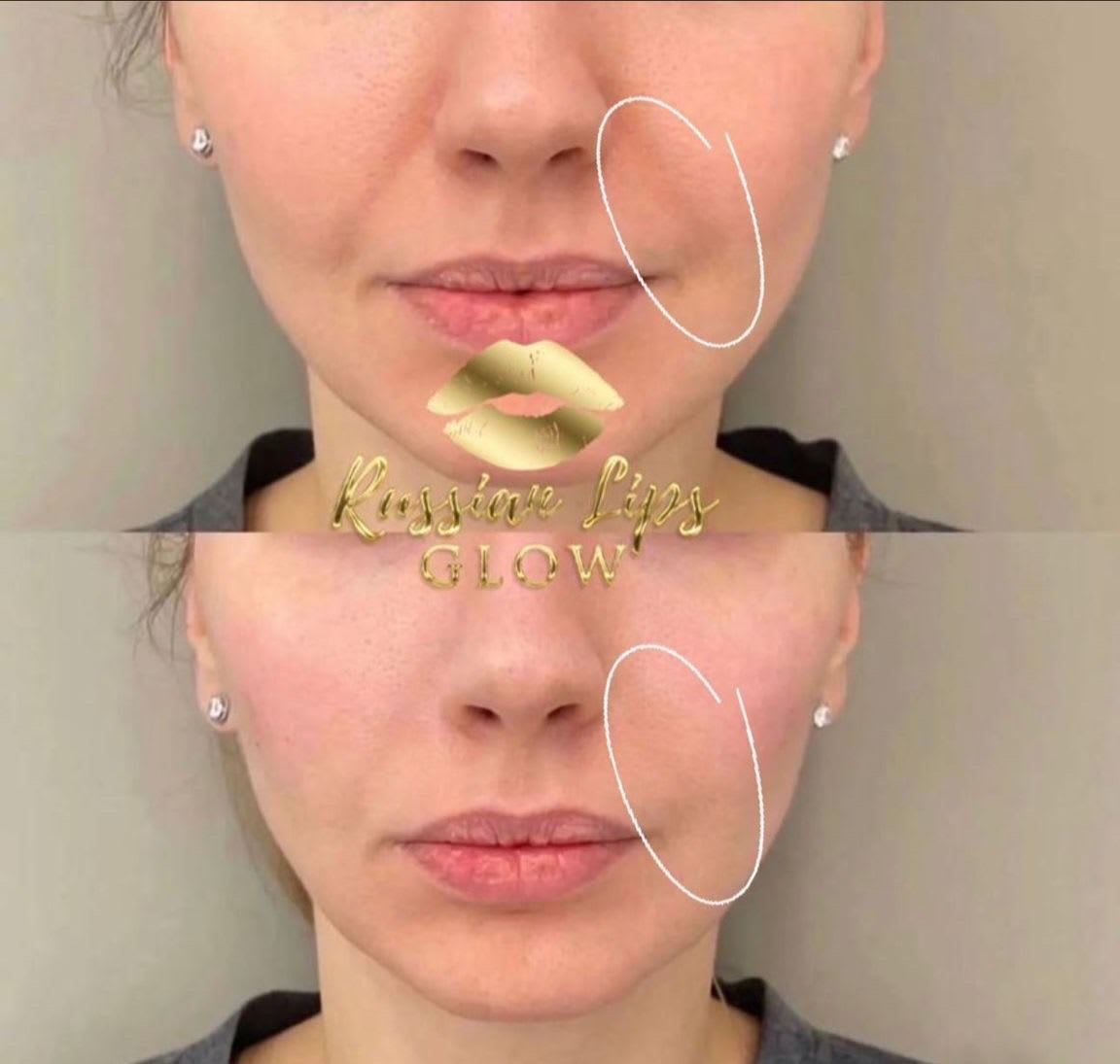 Glow Beauty GmbH gallery image 7