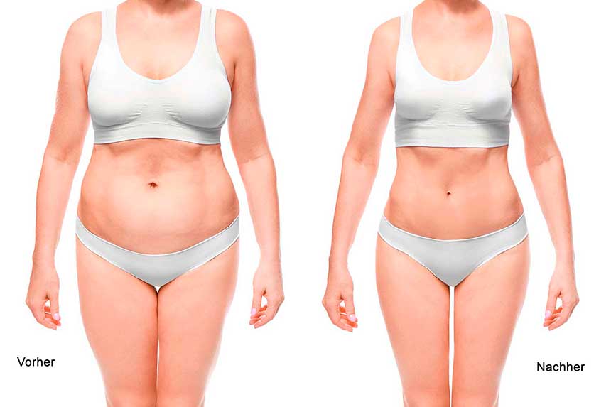 Ästhetische Medizin | Ästhetische Chirurgie in Zürich gallery image 5