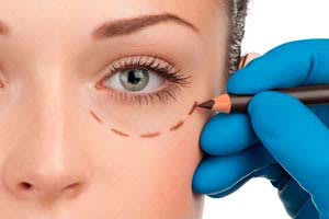 Ästhetische Medizin | Ästhetische Chirurgie in Zürich gallery image 6