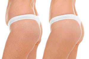 Ästhetische Medizin | Ästhetische Chirurgie in Zürich gallery image 7