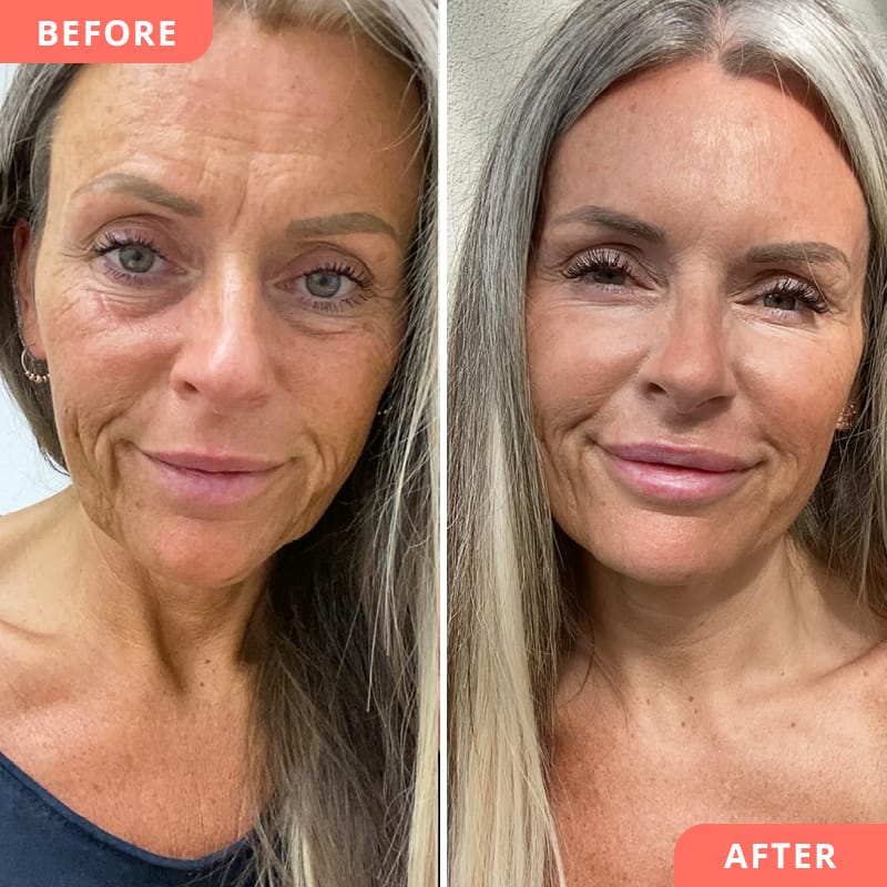 Beauty2Go Klinik - Luzern gallery image 6