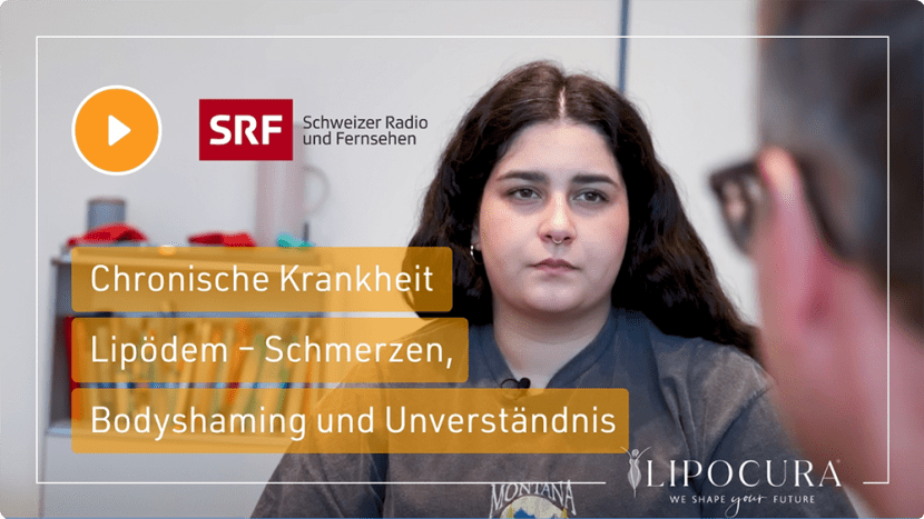 LIPOCURA® Zürich gallery image 7