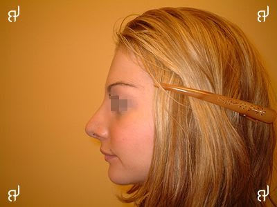 Dr Laurent BENADIBA gallery image 2