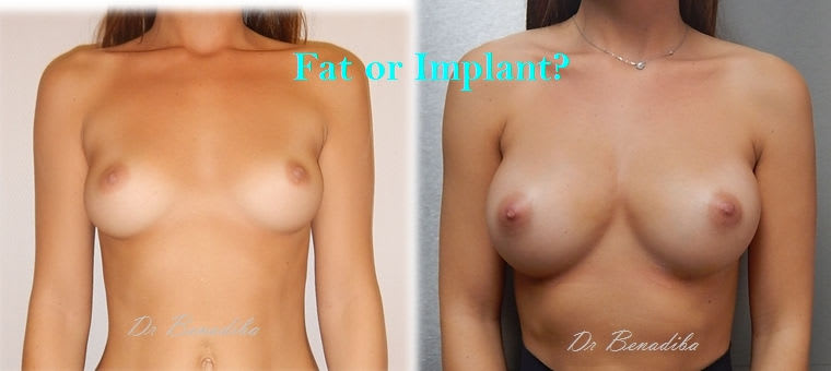 Dr Laurent BENADIBA gallery image 9