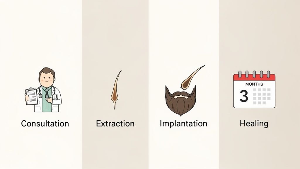 Passaggi illustrati di un trapianto di capelli per barba: consultazione, estrazione, impianto e 3 mesi di guarigione.