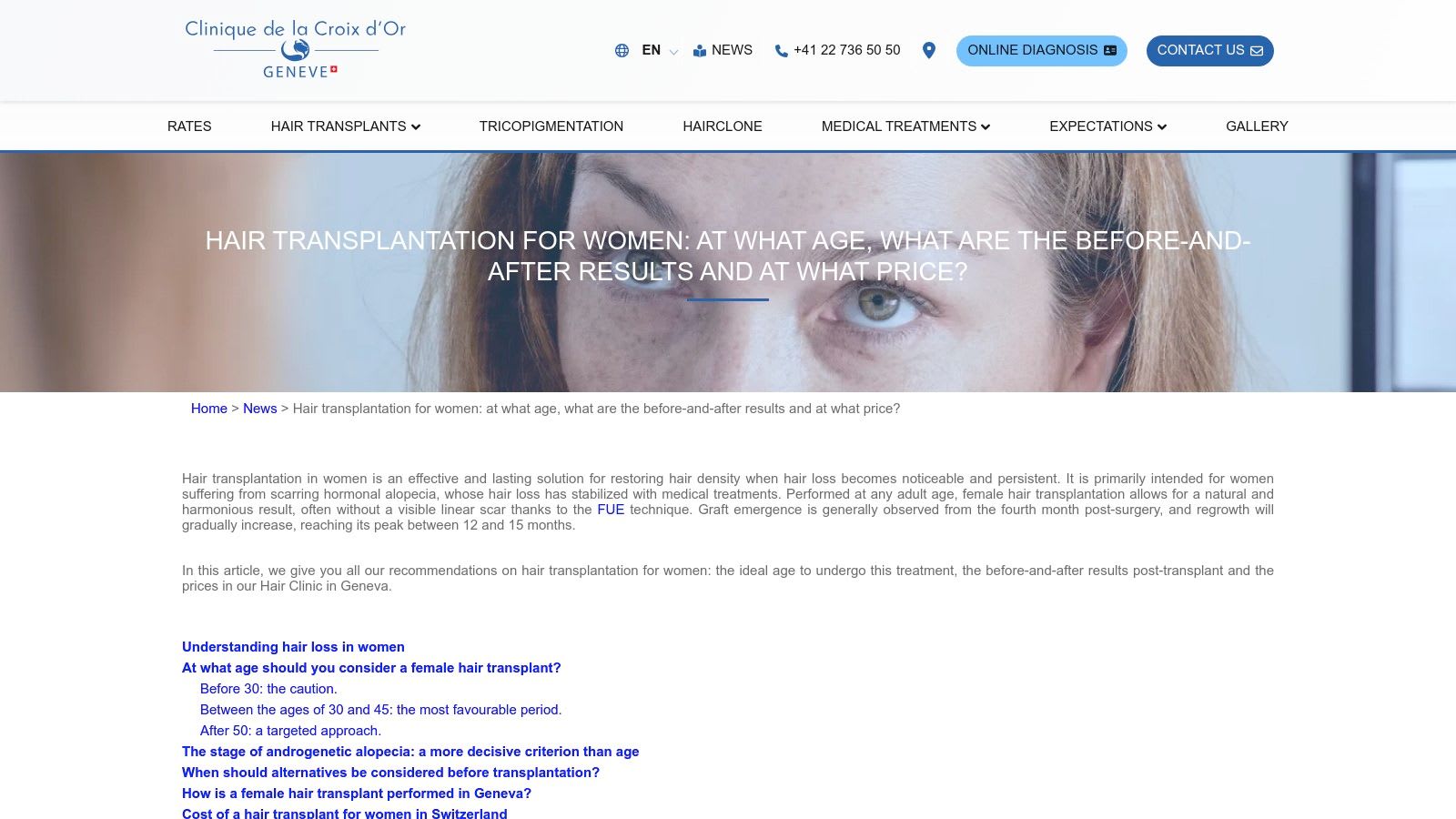 Clinique du Cheveu – Croix d’Or Hair Clinic (Geneva)