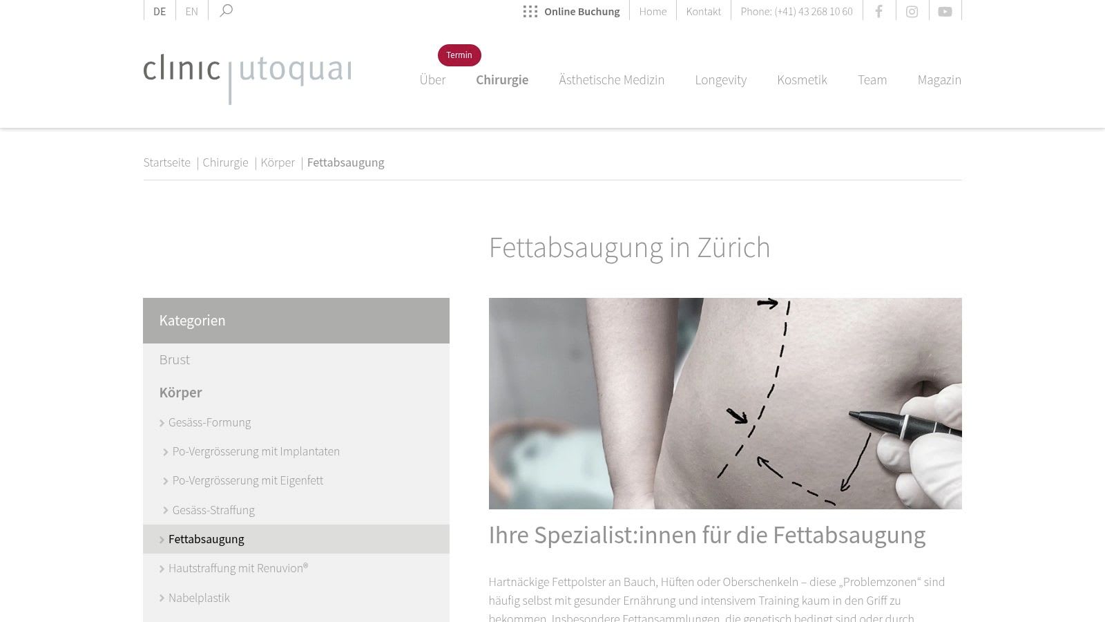 Klinik Utoquai in Zürich erklärt den Planungsprozess für Fettabsaugen, zeigt Markierungen auf dem Bauch eines Patienten vor dem Eingriff.