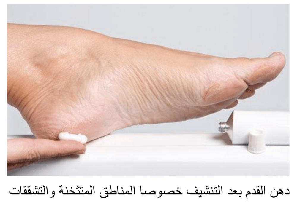 دهن القدم يومياً
