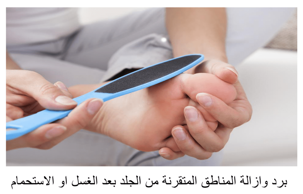 برد الاماكن المتثخنة