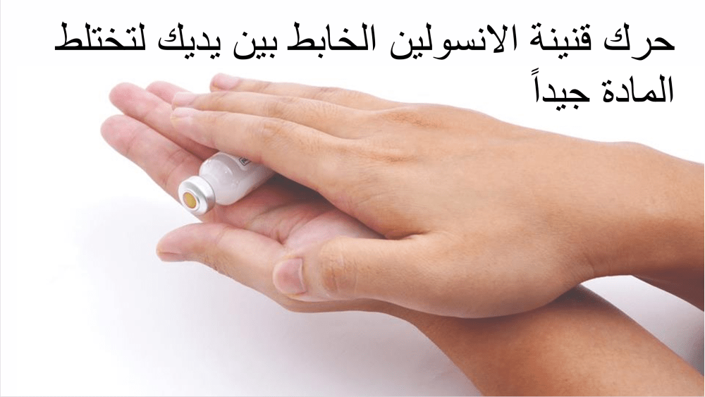 التحريك لغرض التجانس