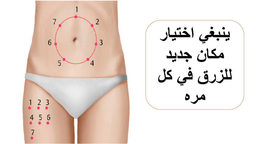 تجديد مكان الزرق