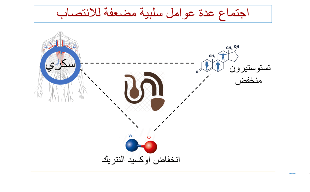 تعدد العوامل السلبية