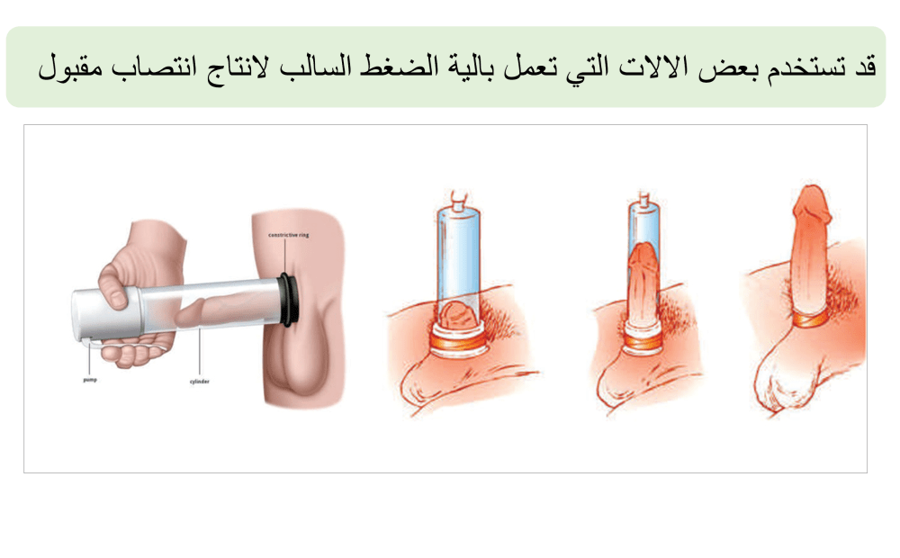 اداة الشفط السالب