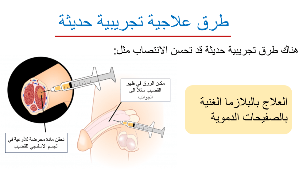 علاجات تجريبية