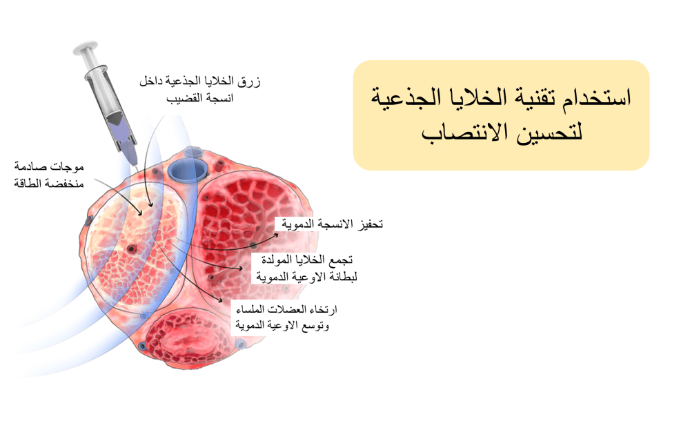 تجديد الانسجة بالخلايا الجذعية