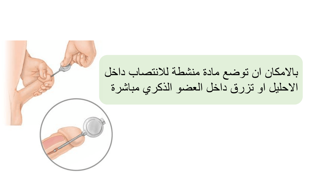 التحاميل الاحليلية