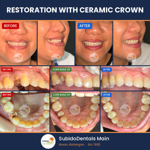 Before and after dental case