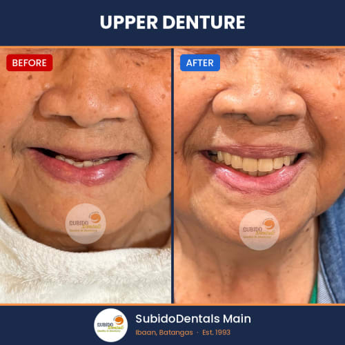 Before and after dental case