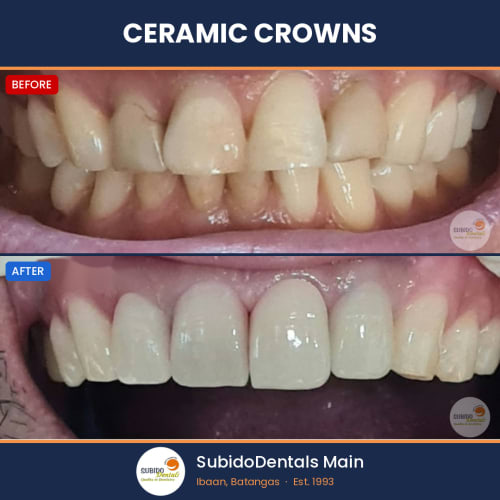 Before and after dental case