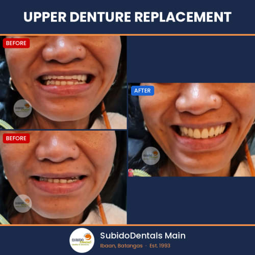 Before and after dental case