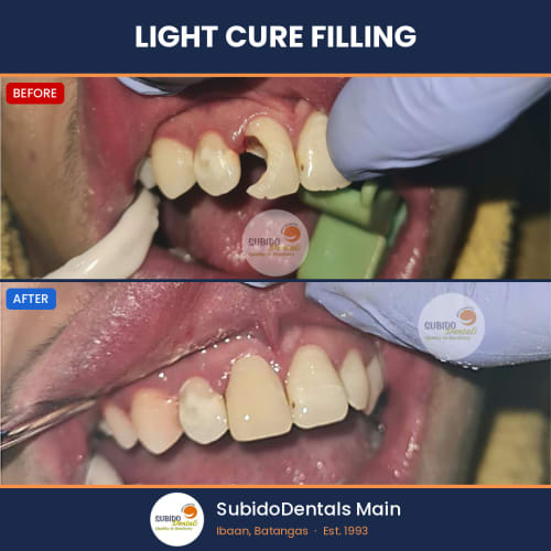 Before and after dental case
