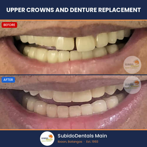 Before and after dental case