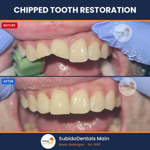 Before and after dental case