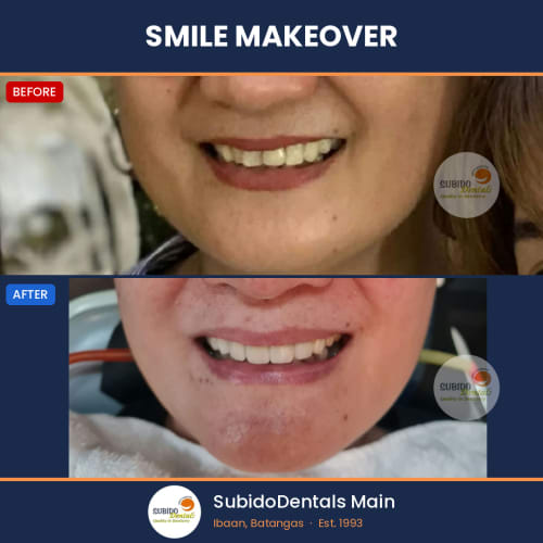 Before and after dental case