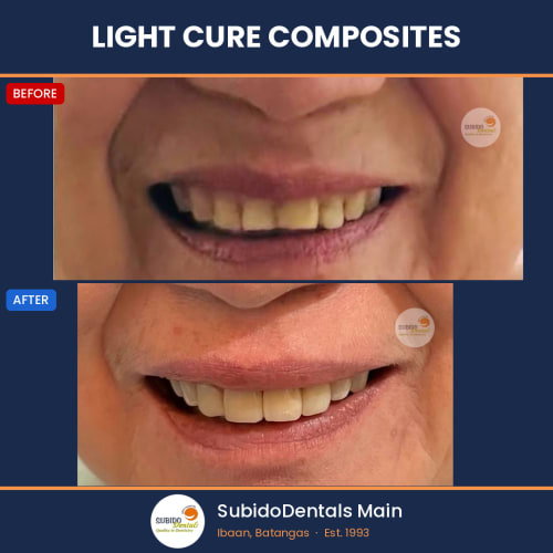 Before and after dental case