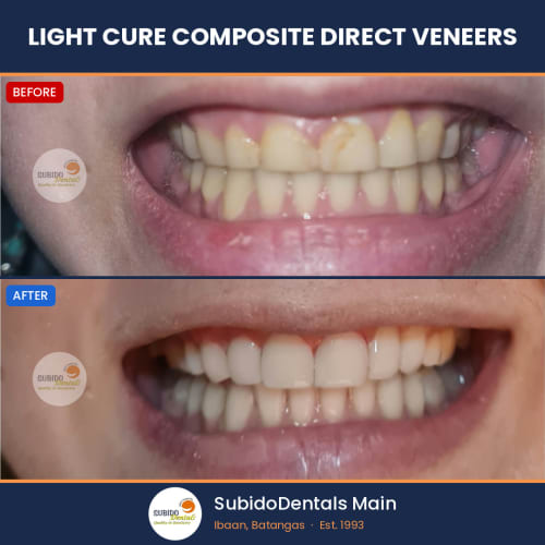 Before and after dental case