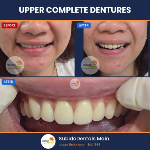 Before and after dental case