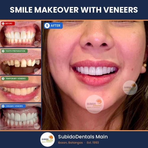 Before and after dental case