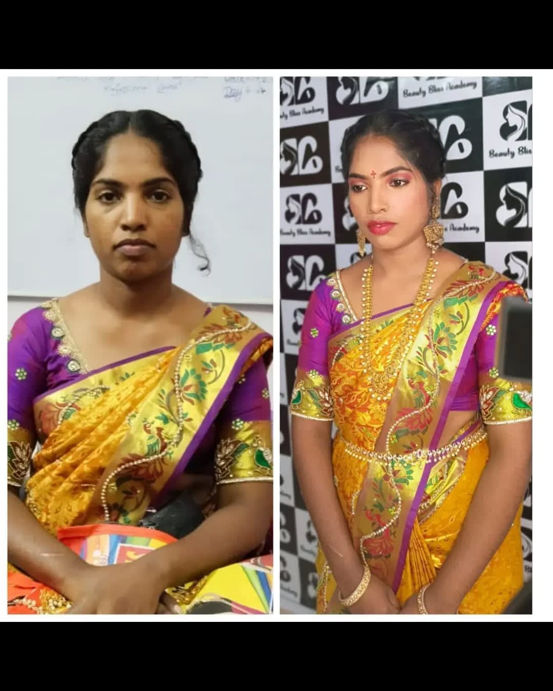 Skin Transformation