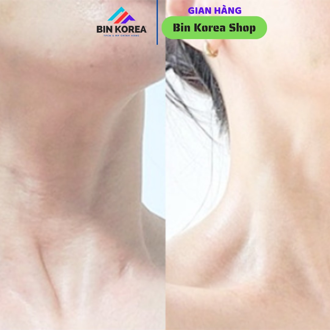 Kem Dưỡng Da Vùng Cổ Medipeel Phiên Bản Mới 3.0 Hũ 100ml thumbnail 9