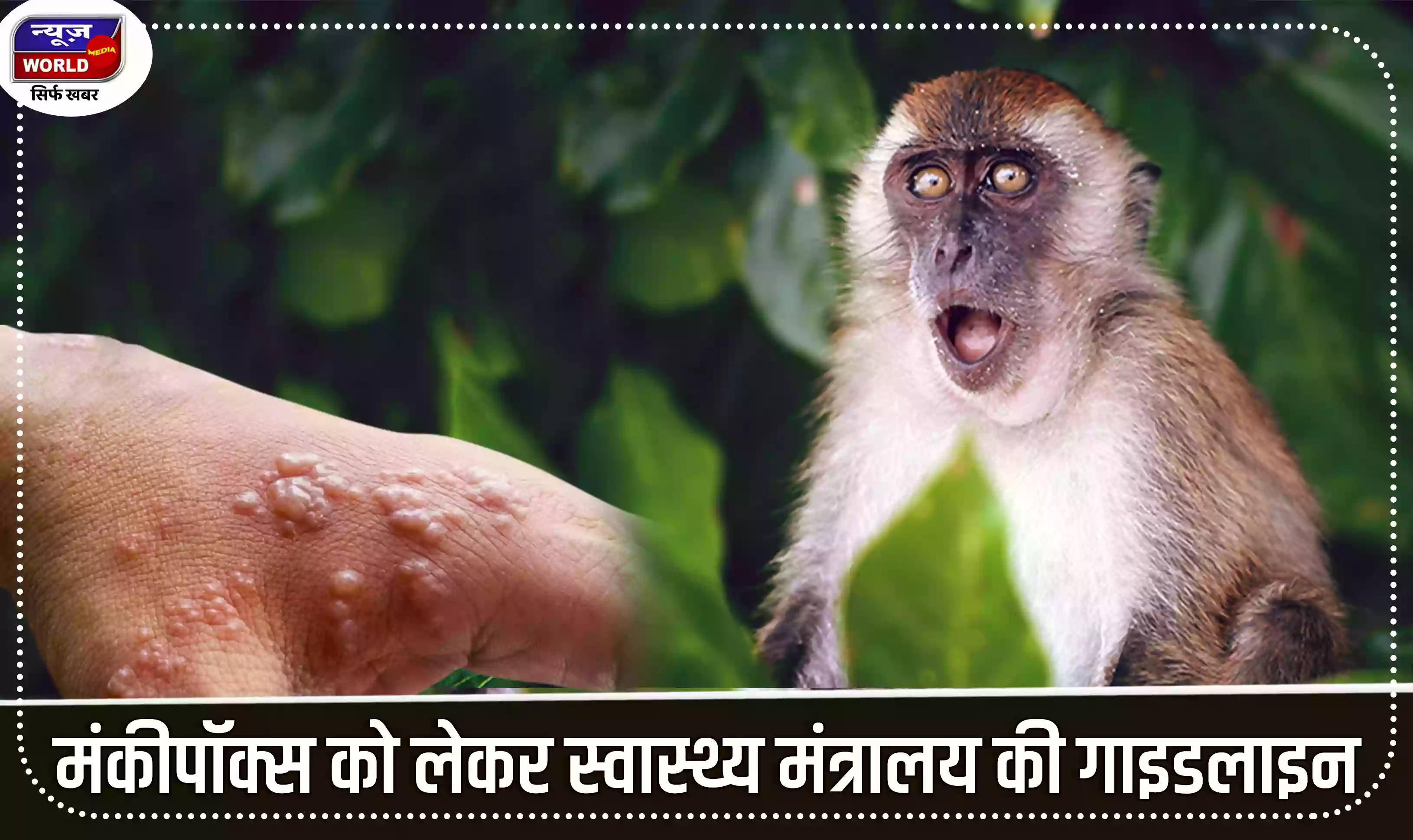 मंकीपॉक्स को लेकर स्वास्थ्य मंत्रालय ने जारी की गाइडलाइन
