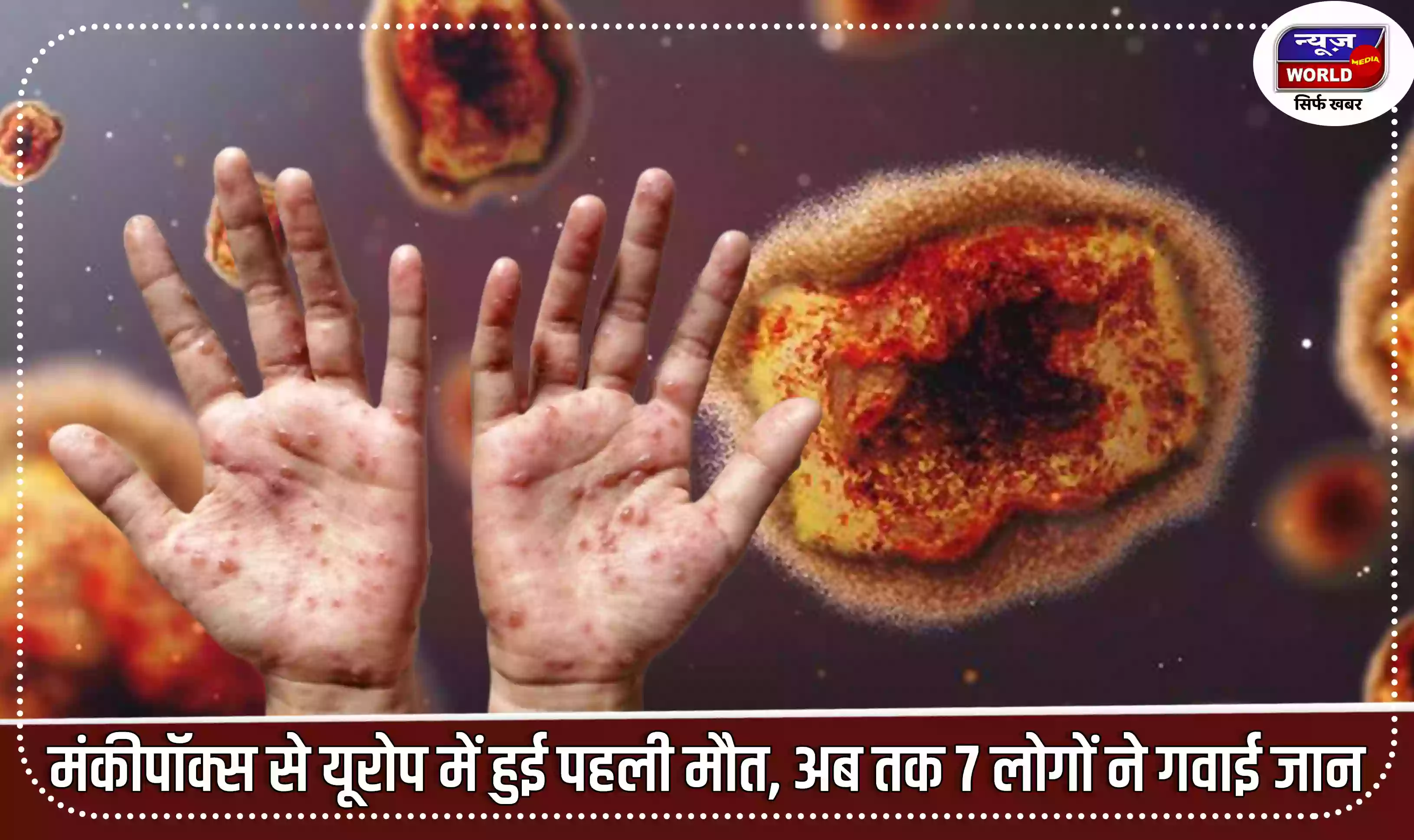 मंकीपॉक्स से यूरोप में हुई पहली मौत, इस वायरस से अब तक 7 लोगों ने गवाई जान