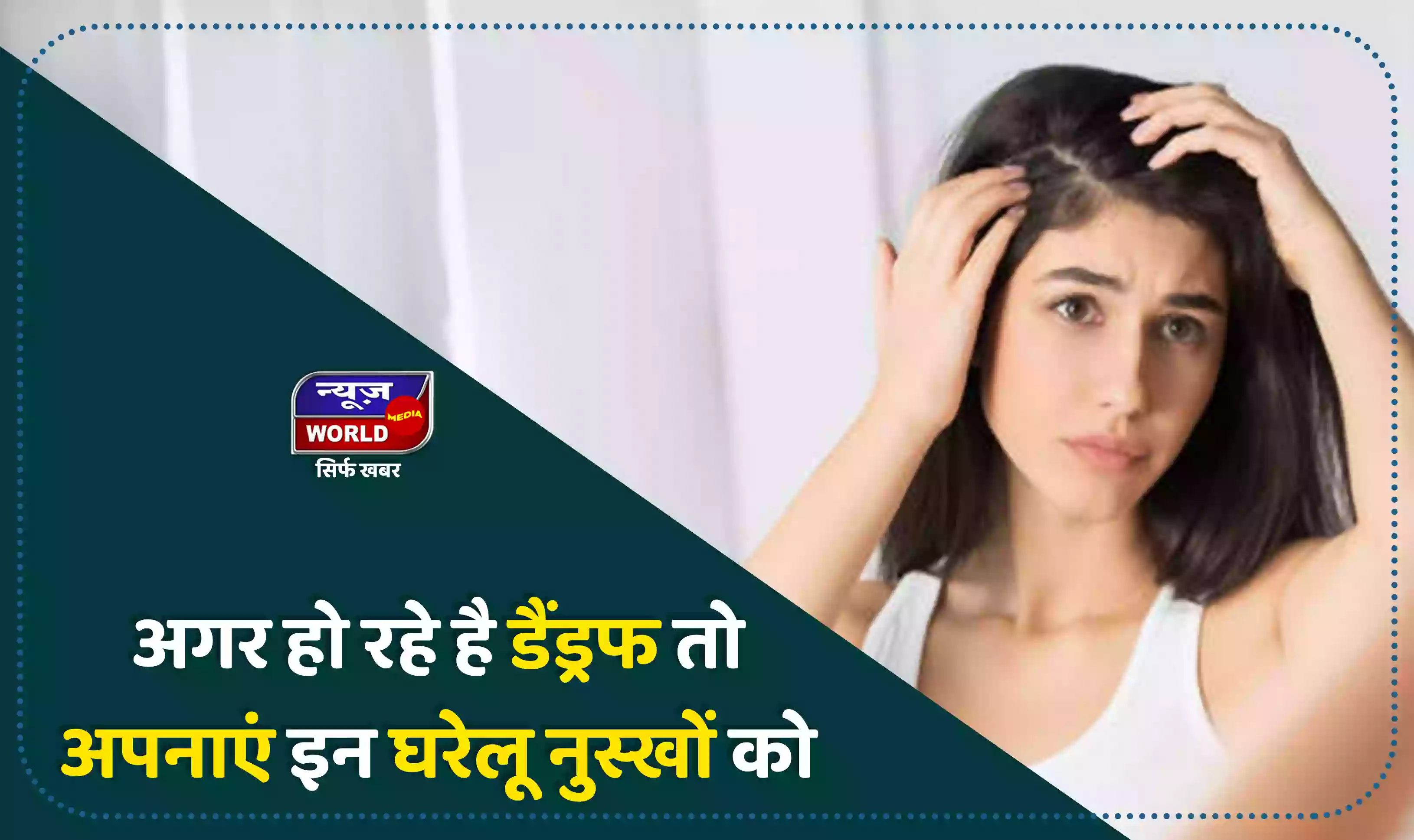 बालों में हो रहे डैंड्रफ से हैं परेशान तो अपनाएं इन घरेलू नुस्खों को, बाल होंगे मजबूत और सुंदर