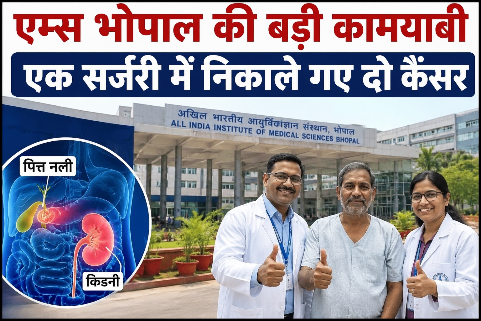 एम्स भोपाल ने रचा इतिहास, एक ही ऑपरेशन में दो अलग-अलग कैंसर का सफल इलाज