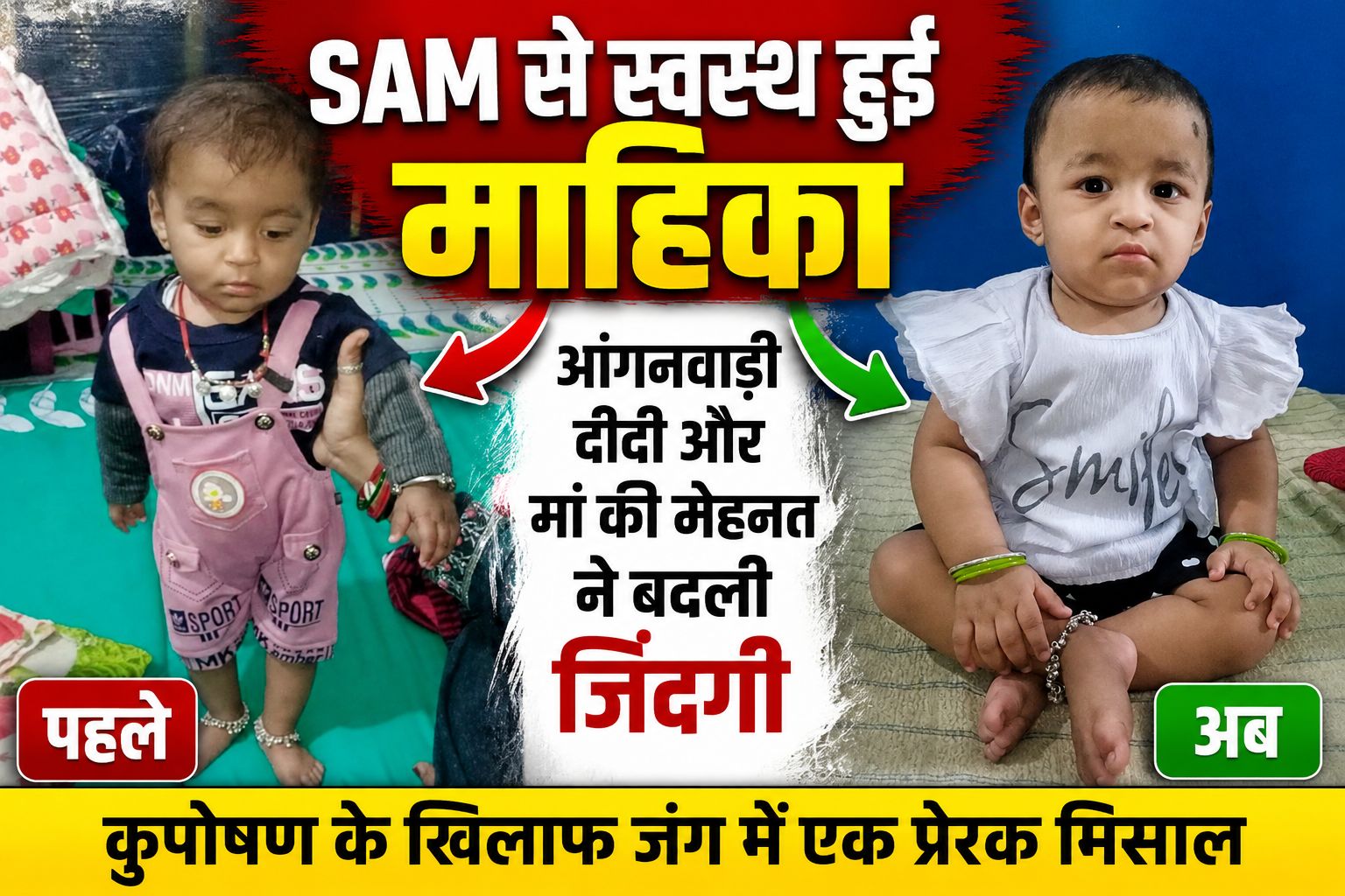 आंगनवाड़ी दीदी की पहल से कुपोषण को मात, SAM श्रेणी से पूरी तरह स्वस्थ हुई मासूम माहिका