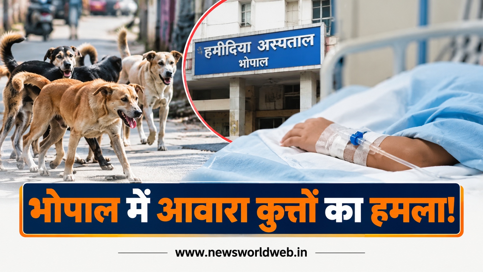 भोपाल में आवारा कुत्तों का खौफ, घर में घुसकर 8 साल के बच्चे को काटा, चेहरे पर चार घाव और सर्जरी