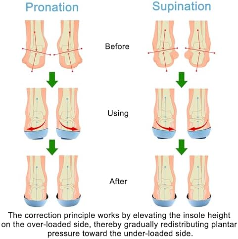 Vue 2 de Endoto Semelles Orthopediques De