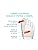 Vue 5 de Epitact Orthese Hallux Valgus